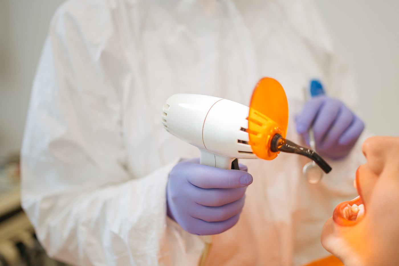 Aplicación de lámpara de fotocurado durante un tratamiento dental